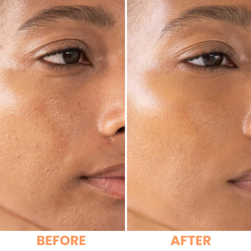 Hormone-Balance Enzyme Exfoliating Gel